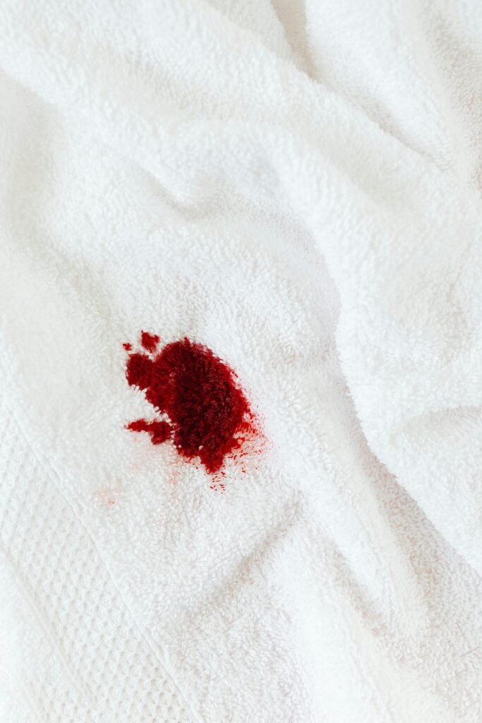 Advanced Stain Removal